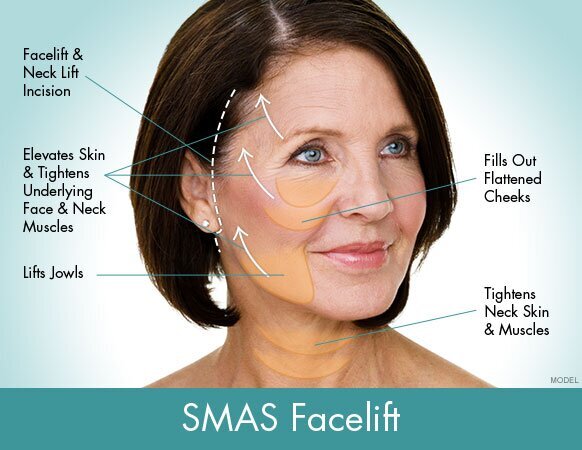 What is The Natural Facelift?, Blog